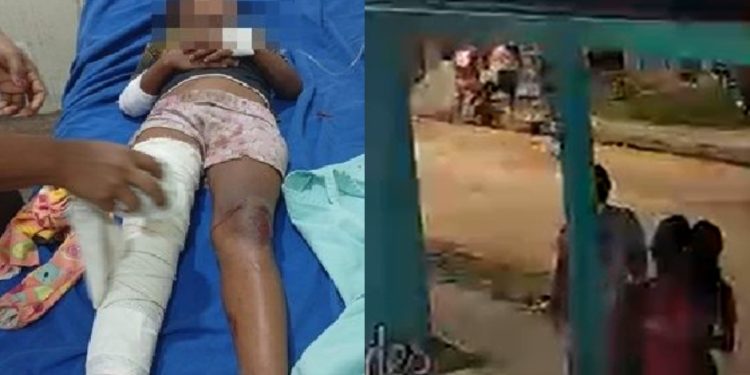 Vídeo: menina de 8 anos é atr0pelada por moto e grita de dor no Amazonas