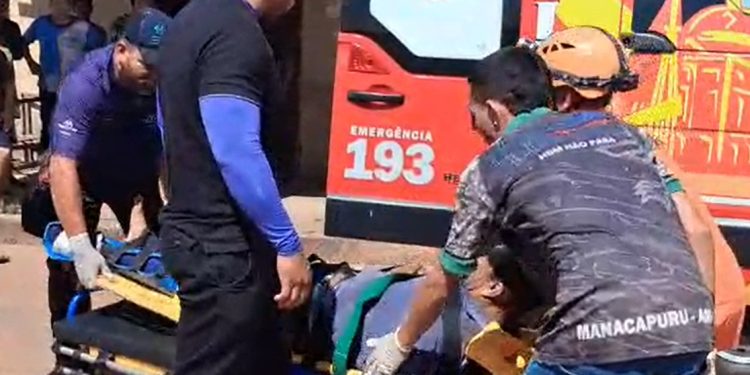Vídeo forte: condutor fica com o pé destruíd0 após ch0que de motos no Amazonas