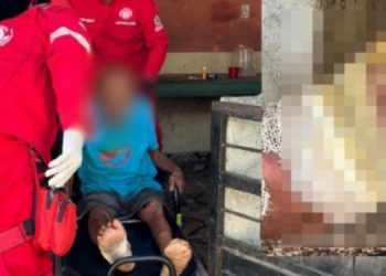 Idoso é deixado com o pé machucad0 e sem cartão do benefício em Parintins