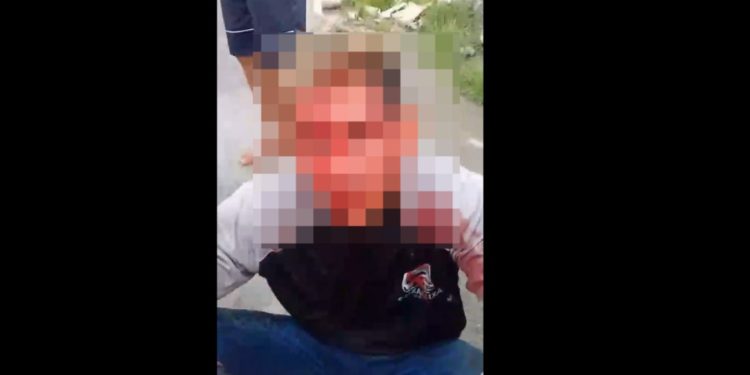Vídeo: todo arrebentad0, suspeit0 que esfaque0u homem em Manaus é interrogado: ‘tu furou meu pai’