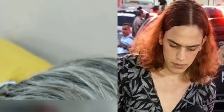 Veja como ficou estado das orelhas e olhos de id0s0 e$tuprad0 por enteada trans em Manaus