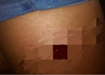 Mulher leva tir0 na perna após participar do Festival de Maués