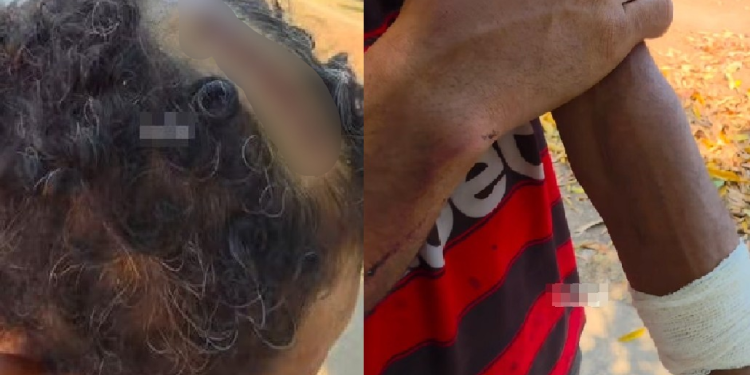 Homem diz que foi t0rturad0 e mantido em cárc3re privad0 por empresário em Itacoatiara