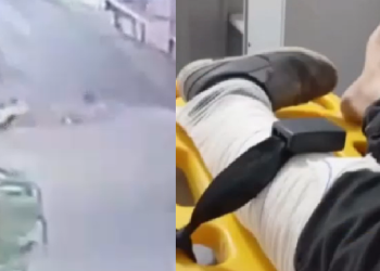 Vídeo: Ac1dente gr@ve em cruzamento deixa mototaxista com a perna qu3brada em Tefé