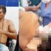 Vídeo forte: médicos retiram arpão de pesca da cabeça de pescador no SPA