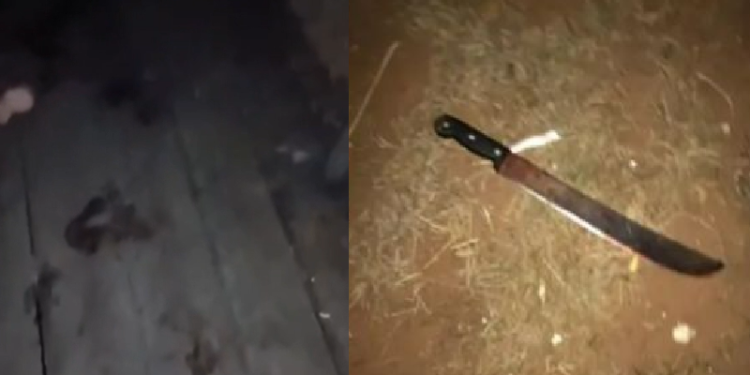 Vídeo: Durante discussã0 com a esposa, homem pega terçado e c0rta fora a mão dela
