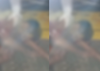 Vídeo: Em Maués, homem fica com a língu@ pendurada após ser furad0 em estrada